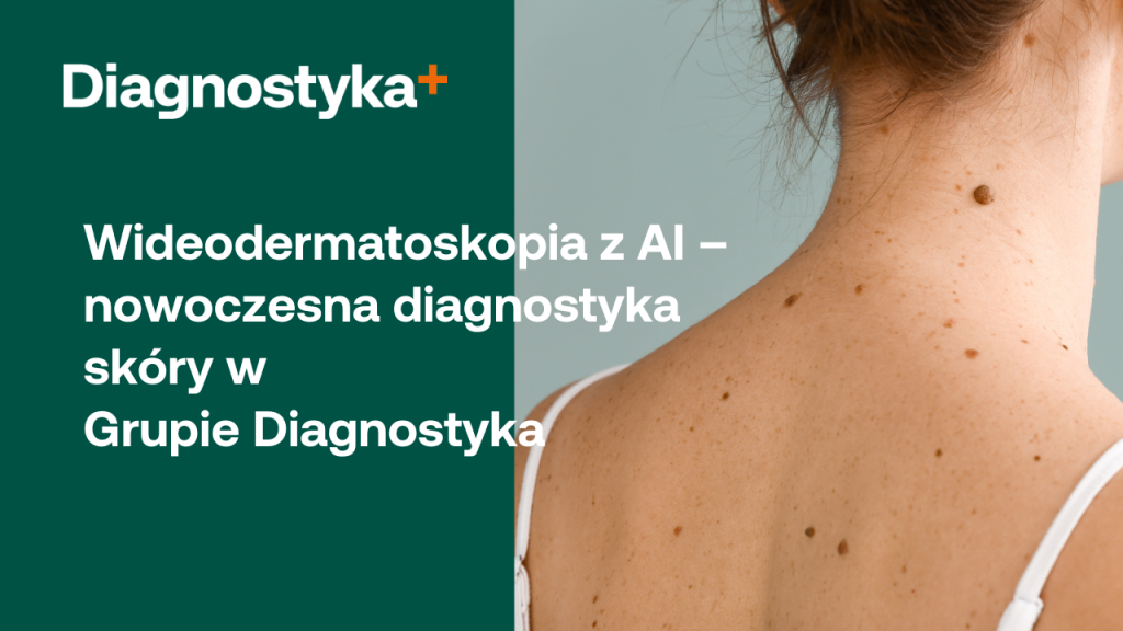 Nowa era profilaktyki dermatologicznej – wideodermatoskopia z AI